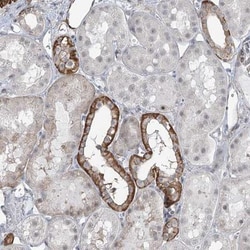 TXLNB Antibody, Novus Biologicals 0.1mL; Unlabeled:Antibodies, Polyclonal