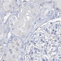 TXLNB Antibody, Novus Biologicals 0.1mL; Unlabeled:Antibodies, Polyclonal