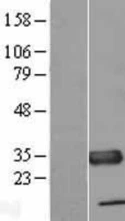 Novus Biologicals&trade;&nbsp;TXNDC Overexpression Lysate