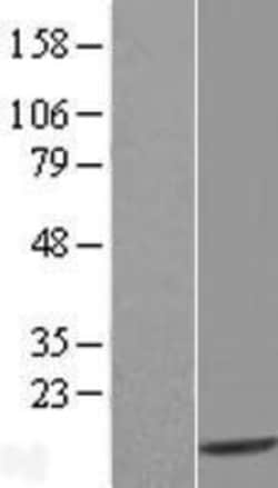 Novus Biologicals™ Thioredoxin-like 5/TRP14/TXNDC17 Overexpression Lysate
