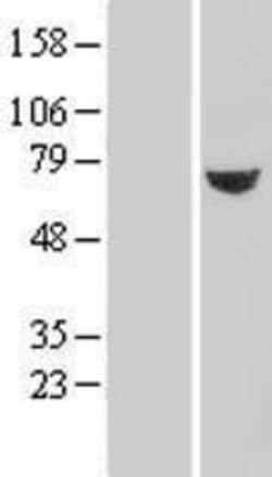 Novus Biologicals&trade;&nbsp;TXNDC3 Overexpression Lysate