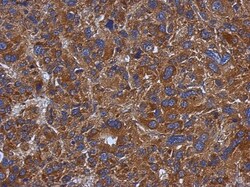 TXNDC5 Antibody, Novus Biologicals 0.1mL; Unlabeled:Antibodies, Polyclonal
