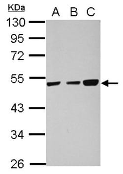 TXNDC5 Antibody, Novus Biologicals 0.1mL; Unlabeled:Antibodies, Polyclonal