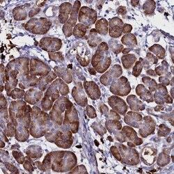 TXNDC5 Antibody, Novus Biologicals 25 &mu;L, Unlabeled:Antibodies, Polyclonal