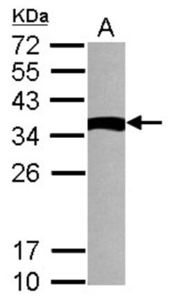 TXNDC6 Antibody, Novus Biologicals 0.1mL; Unlabeled:Antibodies, Polyclonal