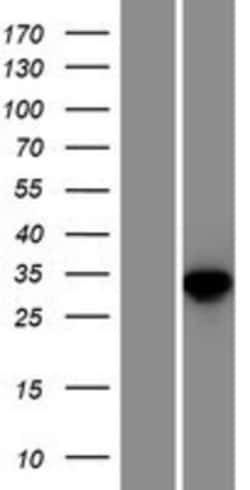 Novus Biologicals™ TXNDC6 Overexpression Lysate