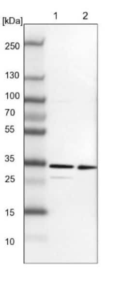 TXNDC9 Antibody, Novus Biologicals 0.1mL; Unlabeled:Antibodies, Polyclonal