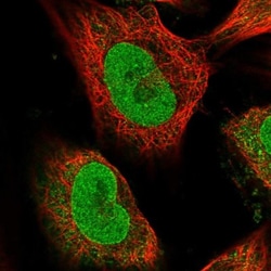 TXNDC9 Antibody, Novus Biologicals 0.1mL; Unlabeled:Antibodies, Polyclonal
