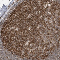 TXNDC9 Antibody, Novus Biologicals 25 &mu;L; Unlabeled:Antibodies, Polyclonal