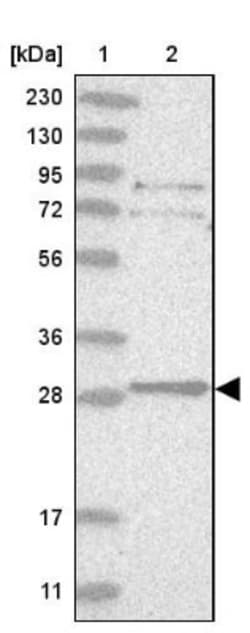 TXNDC9 Antibody, Novus Biologicals 0.1mL; Unlabeled:Antibodies, Polyclonal