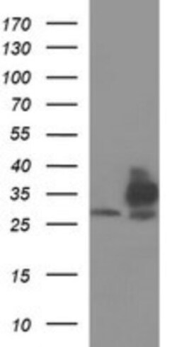 TXNDC Antibody (OTI3H5), Novus Biologicals 0.1mL; Unlabeled:Antibodies,