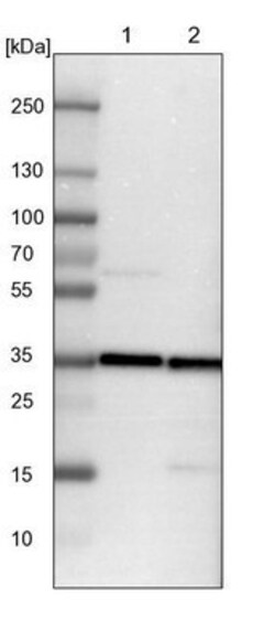 TXNL1 Antibody, Novus Biologicals 0.1mL; Unlabeled:Antibodies, Polyclonal