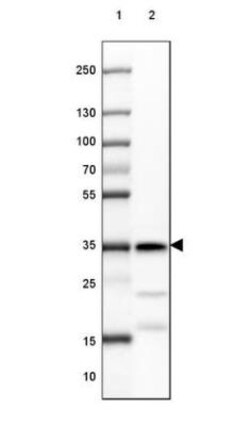 TXNL1 Antibody, Novus Biologicals 0.1mL; Unlabeled:Antibodies, Polyclonal