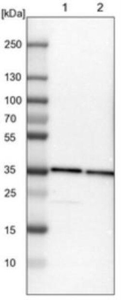 TXNL1 Antibody, Novus Biologicals 0.1mL; Unlabeled:Antibodies, Polyclonal