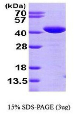 Novus Biologicals Recombinant Human Glutaredoxin 3/GLRX3 His Protein 0.1mg; Unlabeled | Buy Online | Novus Biologicals&trade; | Fisher Scientific