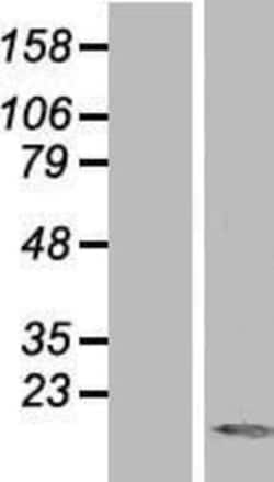 Novus Biologicals&trade;&nbsp;TXNL4A Overexpression Lysate