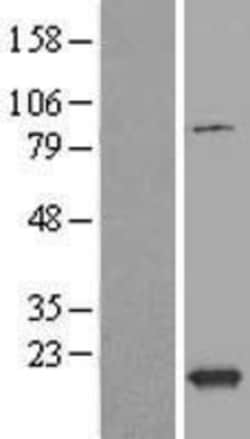 Novus Biologicals&trade;&nbsp;TXNL4B Overexpression Lysate