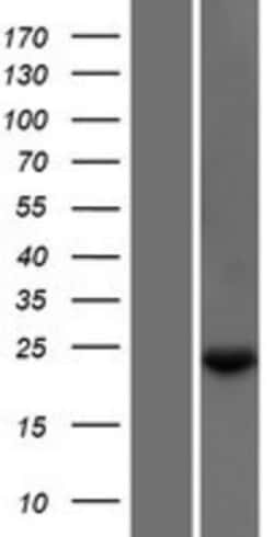 Novus Biologicals™ TXNL6 Overexpression Lysate