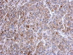 TXNRD2 Antibody, Novus Biologicals 0.1mL; Unlabeled:Antibodies, Polyclonal