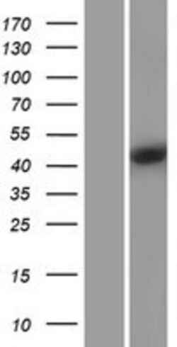 Novus Biologicals™ TYKi Overexpression Lysate