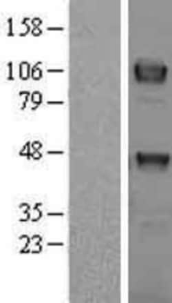 Novus Biologicals&trade;&nbsp;Dtk/TYRO3 Overexpression Lysate