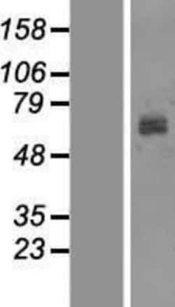 Novus Biologicals™ Tyrosinase Overexpression Lysate