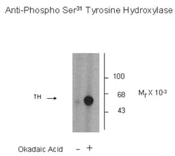 Tyrosine Hydroxylase, p Ser31 Antibody, Novus Biologicals 0.1mL; Unlabeled:Antibodies,