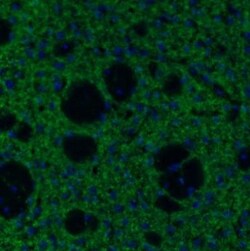 Tyrosine Hydroxylase Antibody, Novus Biologicals:Antibodies:Primary Antibodies