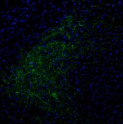 Tyrosine Hydroxylase Antibody, Novus Biologicals:Antibodies:Primary Antibodies