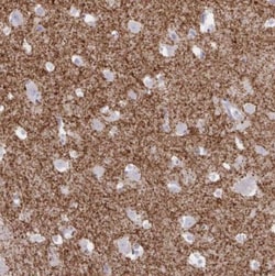 Tyrosine Hydroxylase Antibody, Novus Biologicals:Antibodies:Primary Antibodies