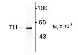 Tyrosine Hydroxylase Antibody, Novus Biologicals 0.1mL; Unlabeled:Antibodies,