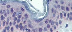 TYRP1 Antibody, Novus Biologicals 0.05mg; Unlabeled:Antibodies, Polyclonal