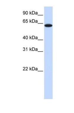 TYRP1 Antibody, Novus Biologicals 0.05mg; Unlabeled:Antibodies, Polyclonal