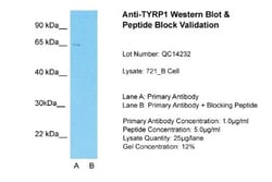 TYRP1 Antibody, Novus Biologicals 0.05mg; Unlabeled:Antibodies, Polyclonal