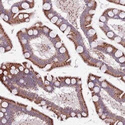 TYW1 Antibody, Novus Biologicals:Antibodies:Primary Antibodies