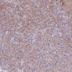 TYW1B Antibody, Novus Biologicals:Antibodies:Primary Antibodies
