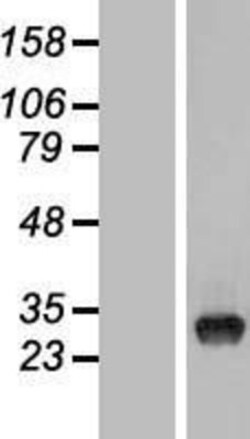 Novus Biologicals&trade;&nbsp;TYW3 Overexpression Lysate