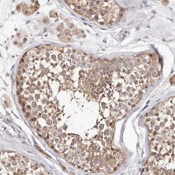 TYW3 Antibody, Novus Biologicals 0.1 mL | Buy Online | Novus Biologicals | Fisher Scientific