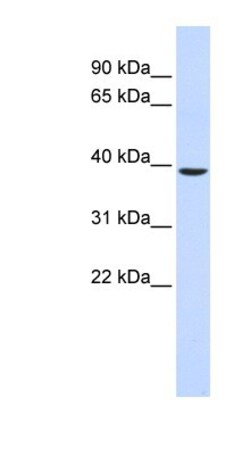 TYW5 Antibody, Novus Biologicals 100&mu;L; Unlabeled:Antibodies, Polyclonal
