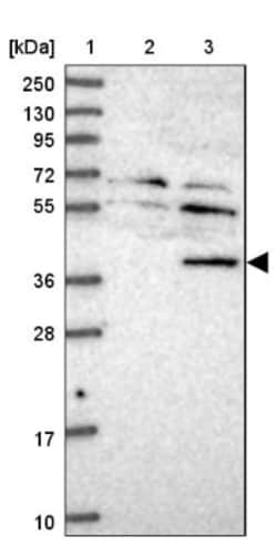 TYW5 Antibody, Novus Biologicals 25 &mu;L, Unlabeled:Antibodies, Polyclonal