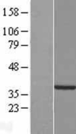 Novus Biologicals&trade;&nbsp;TYW5 Overexpression Lysate