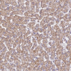 TYW5 Antibody, Novus Biologicals 25 &mu;L, Unlabeled:Antibodies, Polyclonal