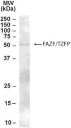 TZFP Antibody, Novus Biologicals 0.1mg; Unlabeled:Antibodies, Polyclonal