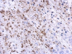 U11/U12-35K Antibody, Novus Biologicals 0.1mL; Unlabeled:Antibodies, Polyclonal