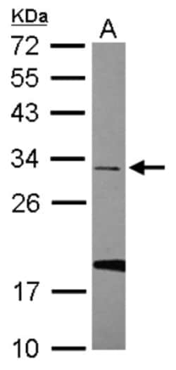 U11/U12-35K Antibody, Novus Biologicals 0.1mL; Unlabeled:Antibodies, Polyclonal