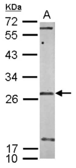 U11/U12-35K Antibody, Novus Biologicals 0.1mL; Unlabeled:Antibodies, Polyclonal