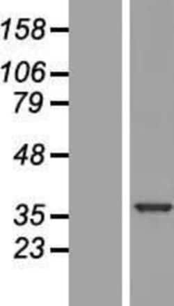 Novus Biologicals&trade;&nbsp;U11/U12-35K Overexpression Lysate