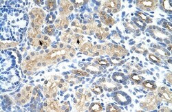 U11/U12-35K Antibody, Novus Biologicals:Antibodies:Primary Antibodies