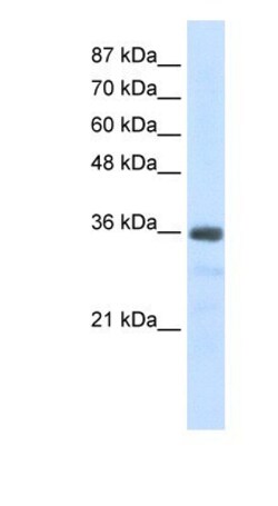 U11/U12-35K Antibody, Novus Biologicals:Antibodies:Primary Antibodies