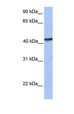 IGFLR1/TMEM149 Antibody, Novus Biologicals 0.05mg; Unlabeled:Antibodies,